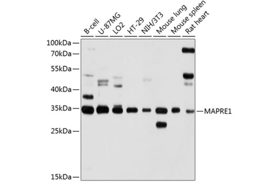 Western Blot - Anti-MAPRE1/EB1 Antibody (A14101) - Antibodies.com