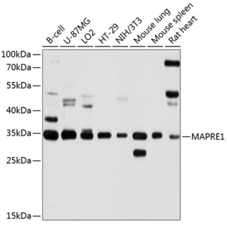 Western Blot - Anti-MAPRE1/EB1 Antibody (A14101) - Antibodies.com