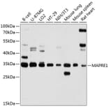 Western Blot - Anti-MAPRE1/EB1 Antibody (A14101) - Antibodies.com
