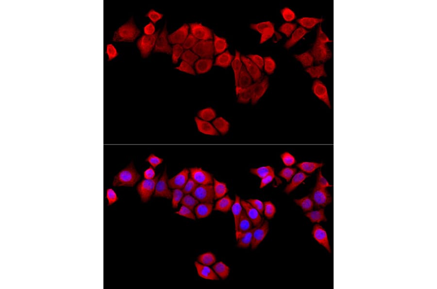 Immunofluorescence - Anti-MAPRE1/EB1 Antibody (A14101) - Antibodies.com