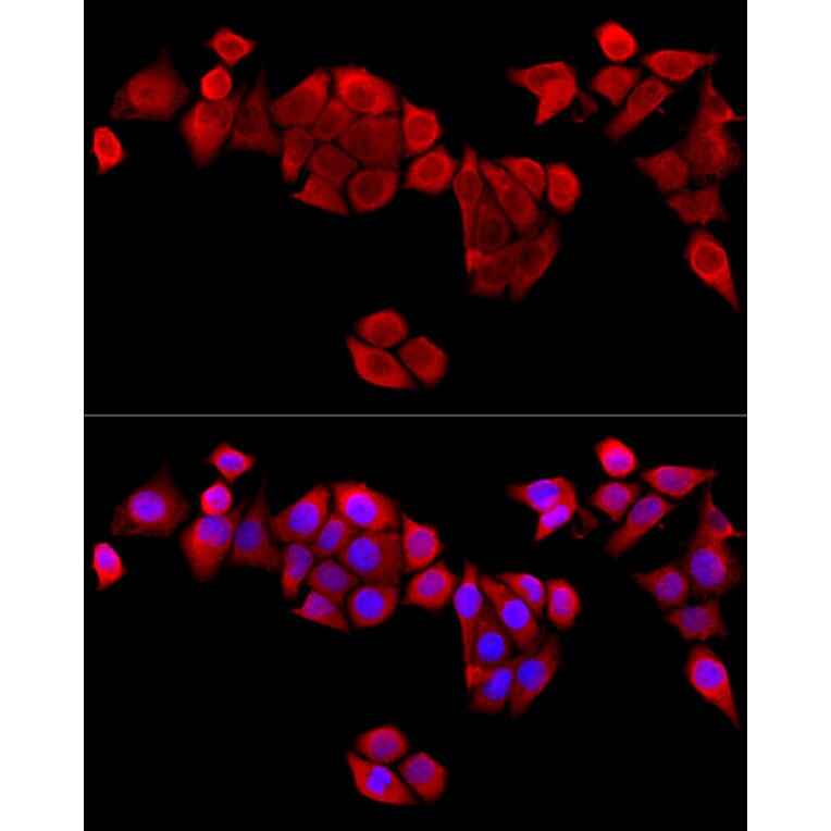 Immunofluorescence - Anti-MAPRE1/EB1 Antibody (A14101) - Antibodies.com