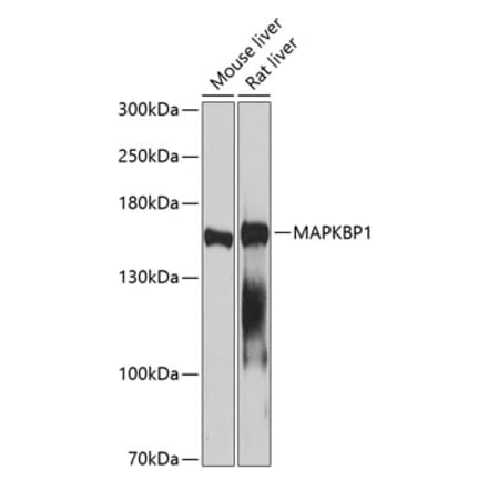 Western Blot - Anti-MAPKBP1 Antibody (A14103) - Antibodies.com