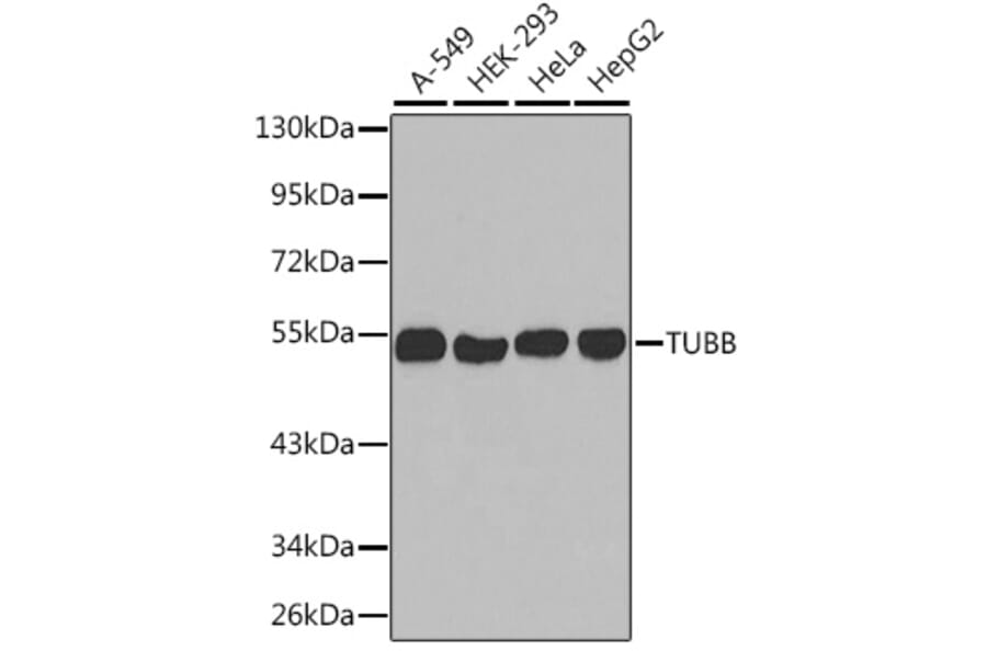 Western Blot - Anti-TUBB Antibody (A2628) - Antibodies.com