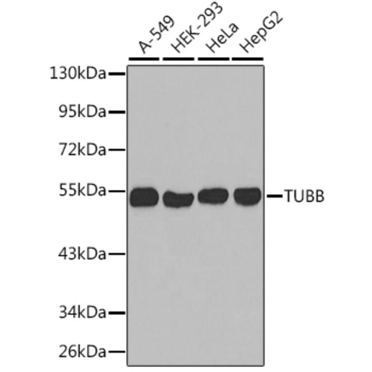 Western Blot - Anti-TUBB Antibody (A2628) - Antibodies.com