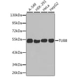 Western Blot - Anti-TUBB Antibody (A2628) - Antibodies.com