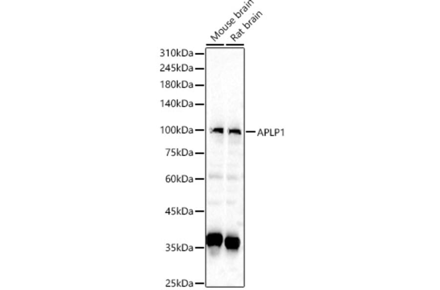 Western Blot - Anti-APLP1 Antibody (A14107) - Antibodies.com