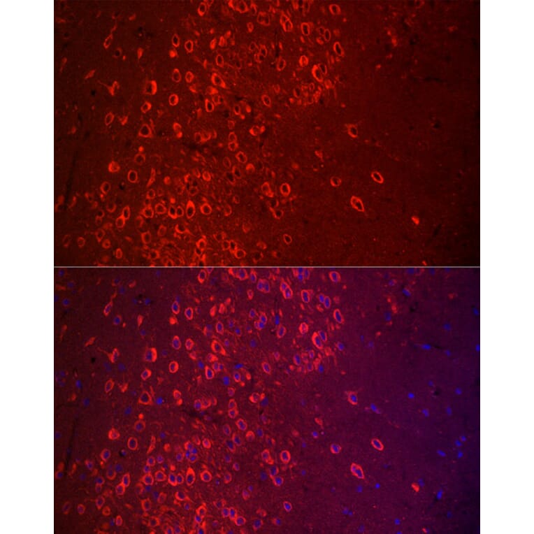 Immunofluorescence - Anti-APLP1 Antibody (A14107) - Antibodies.com