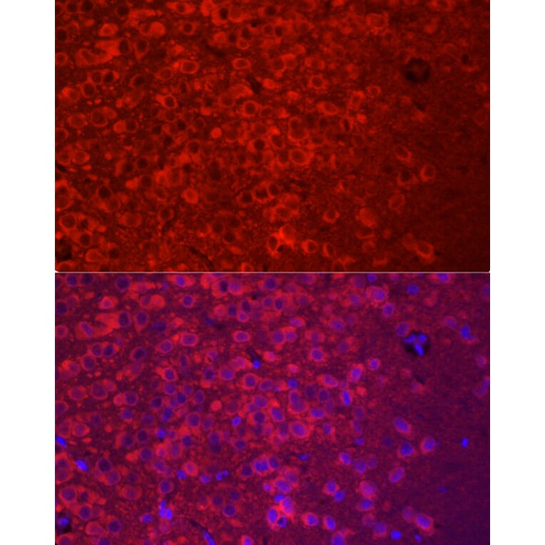 Immunofluorescence - Anti-APLP1 Antibody (A14107) - Antibodies.com