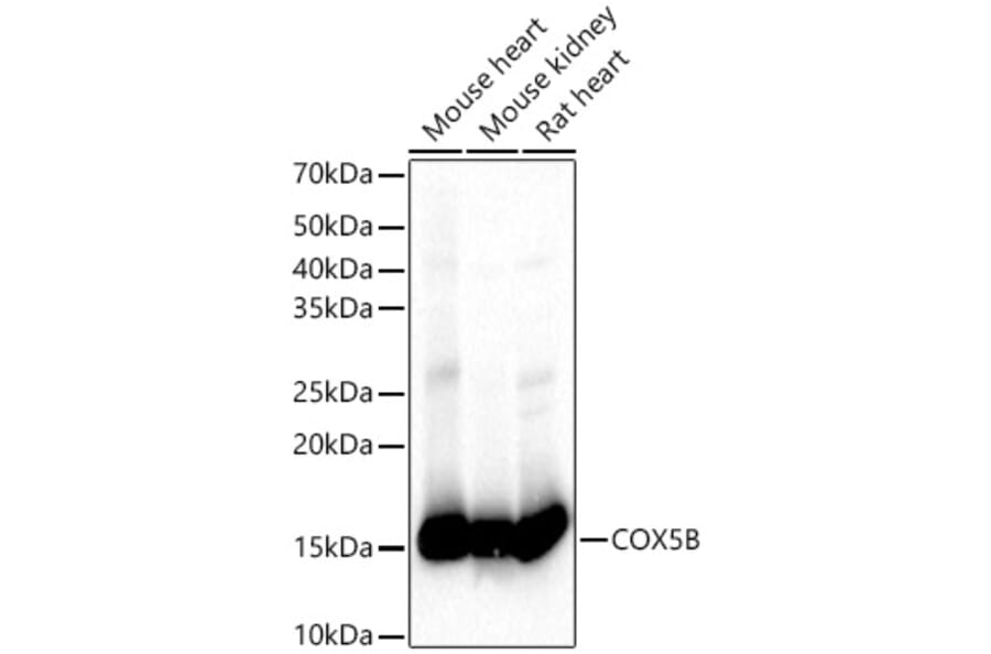 Western Blot - Anti-COX5B Antibody (A14110) - Antibodies.com
