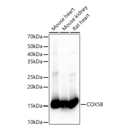 Western Blot - Anti-COX5B Antibody (A14110) - Antibodies.com