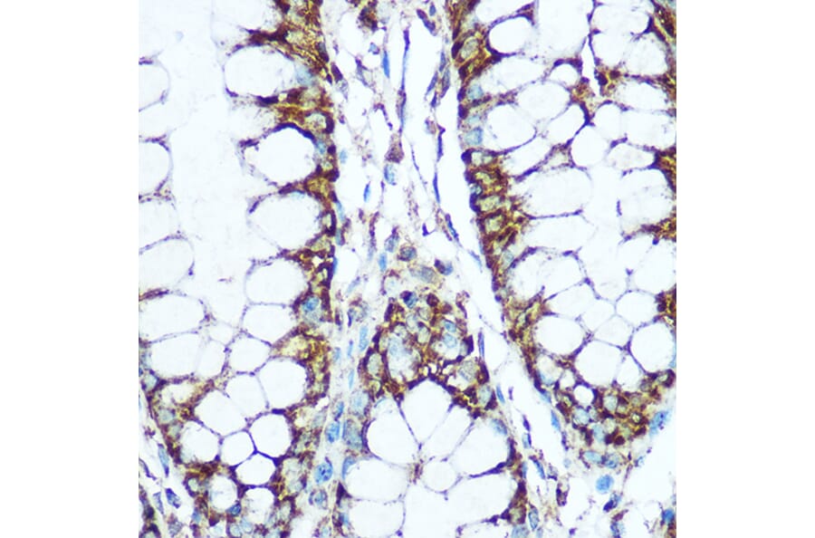Immunohistochemistry - Anti-COX5B Antibody (A14110) - Antibodies.com