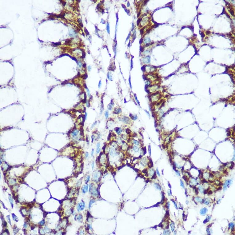 Immunohistochemistry - Anti-COX5B Antibody (A14110) - Antibodies.com