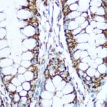 Immunohistochemistry - Anti-COX5B Antibody (A14110) - Antibodies.com