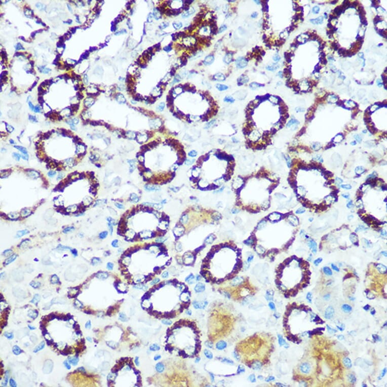 Immunohistochemistry - Anti-COX5B Antibody (A14110) - Antibodies.com