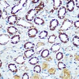 Immunohistochemistry - Anti-COX5B Antibody (A14110) - Antibodies.com