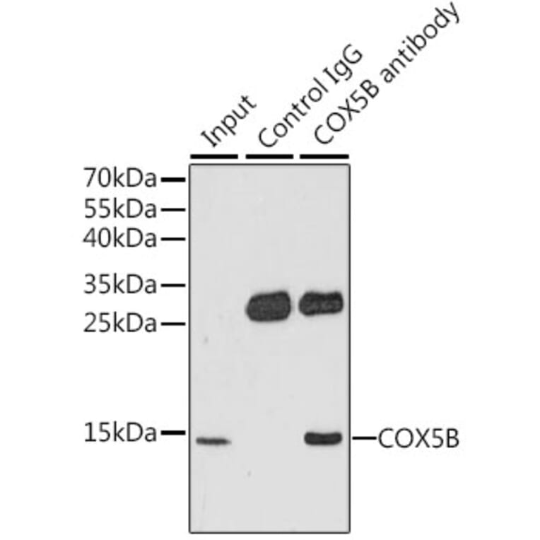 Western Blot - Anti-COX5B Antibody (A14110) - Antibodies.com