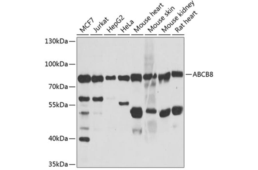 Western Blot - Anti-ABCB8 Antibody (A14116) - Antibodies.com