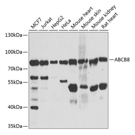 Western Blot - Anti-ABCB8 Antibody (A14116) - Antibodies.com