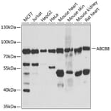 Western Blot - Anti-ABCB8 Antibody (A14116) - Antibodies.com