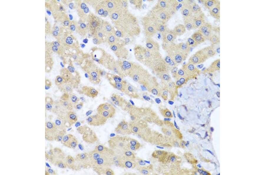 Immunohistochemistry - Anti-ABCB8 Antibody (A14116) - Antibodies.com