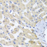 Immunohistochemistry - Anti-ABCB8 Antibody (A14116) - Antibodies.com