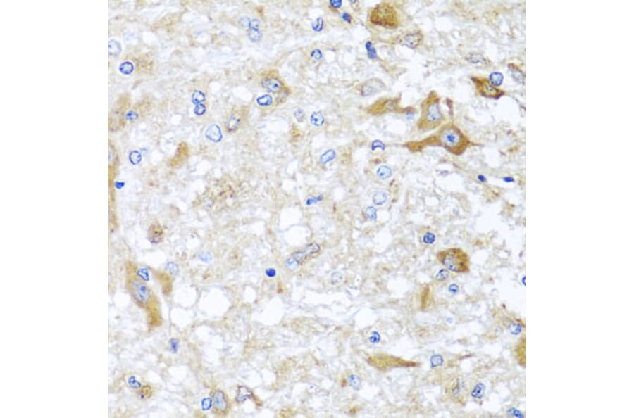 Immunohistochemistry - Anti-ABCB8 Antibody (A14116) - Antibodies.com