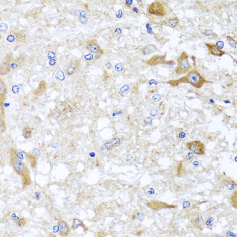 Immunohistochemistry - Anti-ABCB8 Antibody (A14116) - Antibodies.com