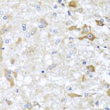 Immunohistochemistry - Anti-ABCB8 Antibody (A14116) - Antibodies.com