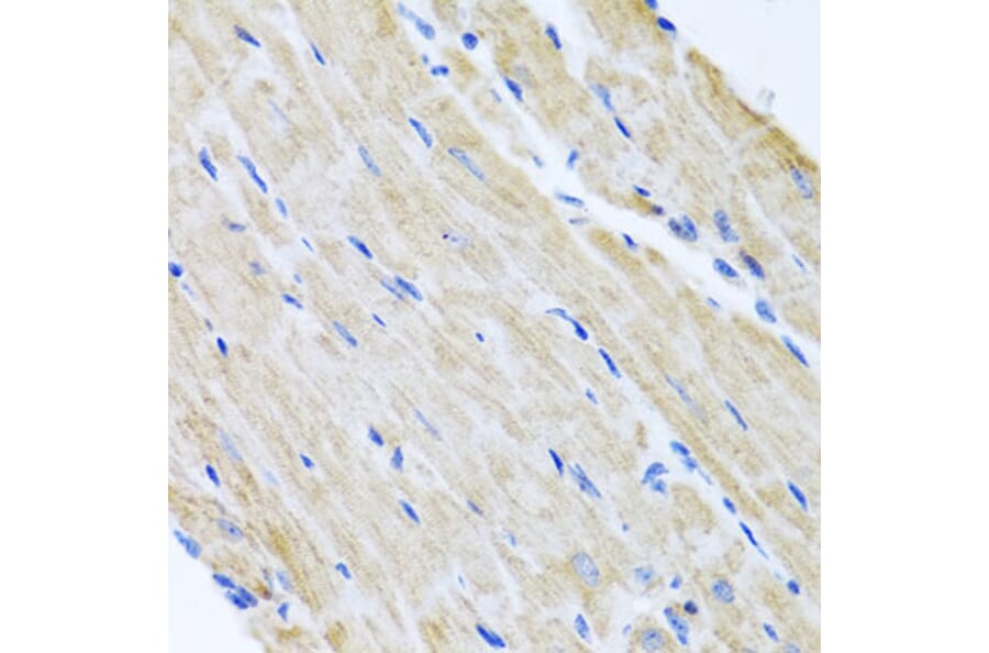 Immunohistochemistry - Anti-ABCB8 Antibody (A14116) - Antibodies.com