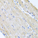 Immunohistochemistry - Anti-ABCB8 Antibody (A14116) - Antibodies.com