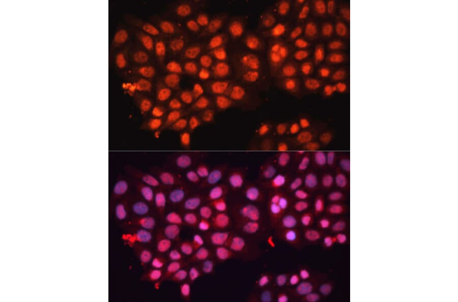 Immunofluorescence - Anti-ABCB8 Antibody (A14116) - Antibodies.com