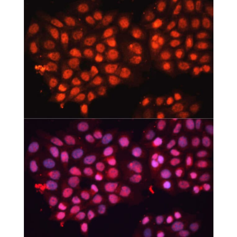 Immunofluorescence - Anti-ABCB8 Antibody (A14116) - Antibodies.com
