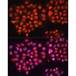 Immunofluorescence - Anti-ABCB8 Antibody (A14116) - Antibodies.com