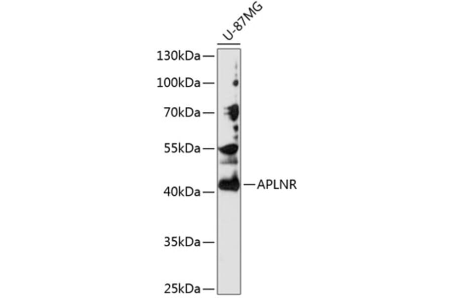 Western Blot - Anti-APLNR Antibody (A2659) - Antibodies.com