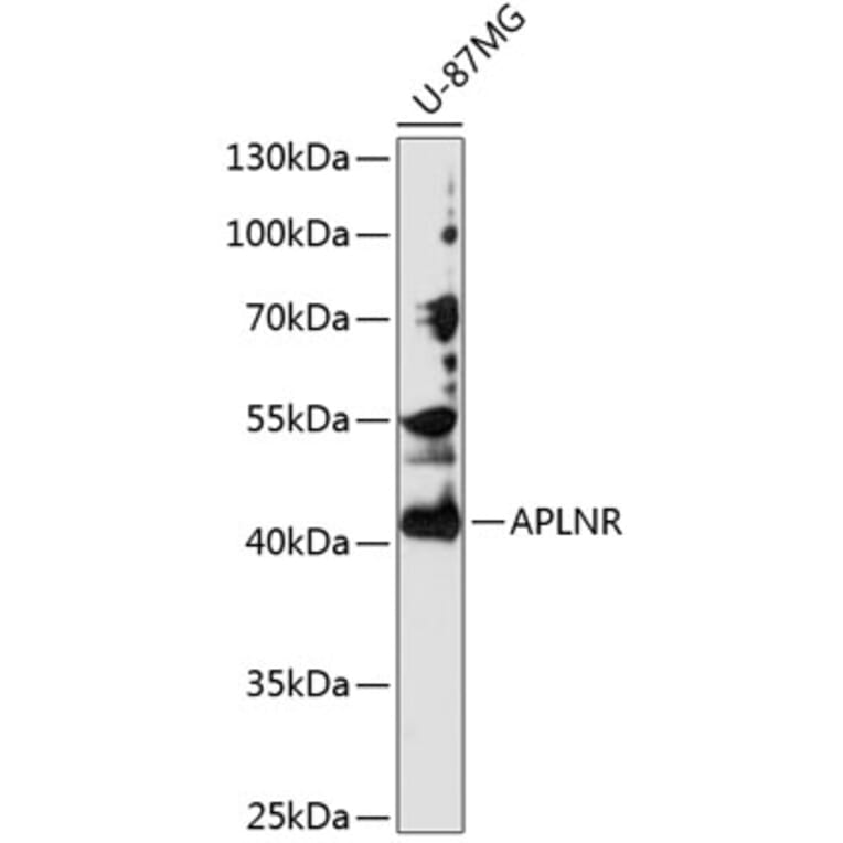 Western Blot - Anti-APLNR Antibody (A2659) - Antibodies.com
