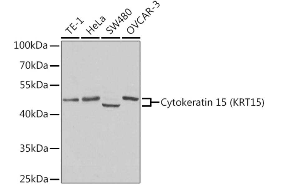 Western Blot - Anti-Cytokeratin 15 Antibody (A14120) - Antibodies.com