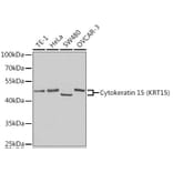 Western Blot - Anti-Cytokeratin 15 Antibody (A14120) - Antibodies.com