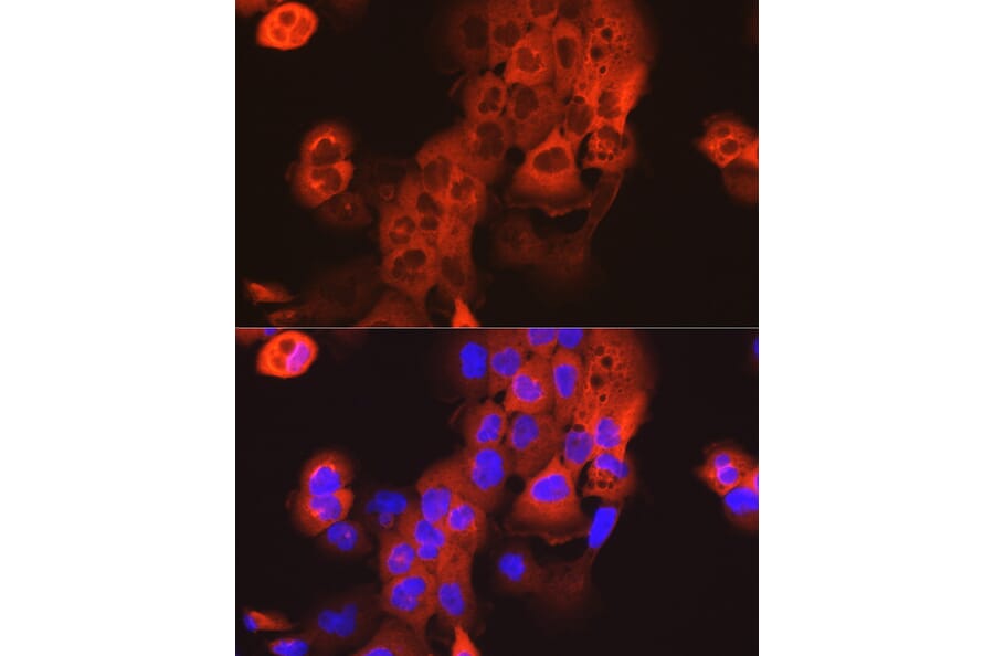 Immunofluorescence - Anti-Cytokeratin 15 Antibody (A14120) - Antibodies.com