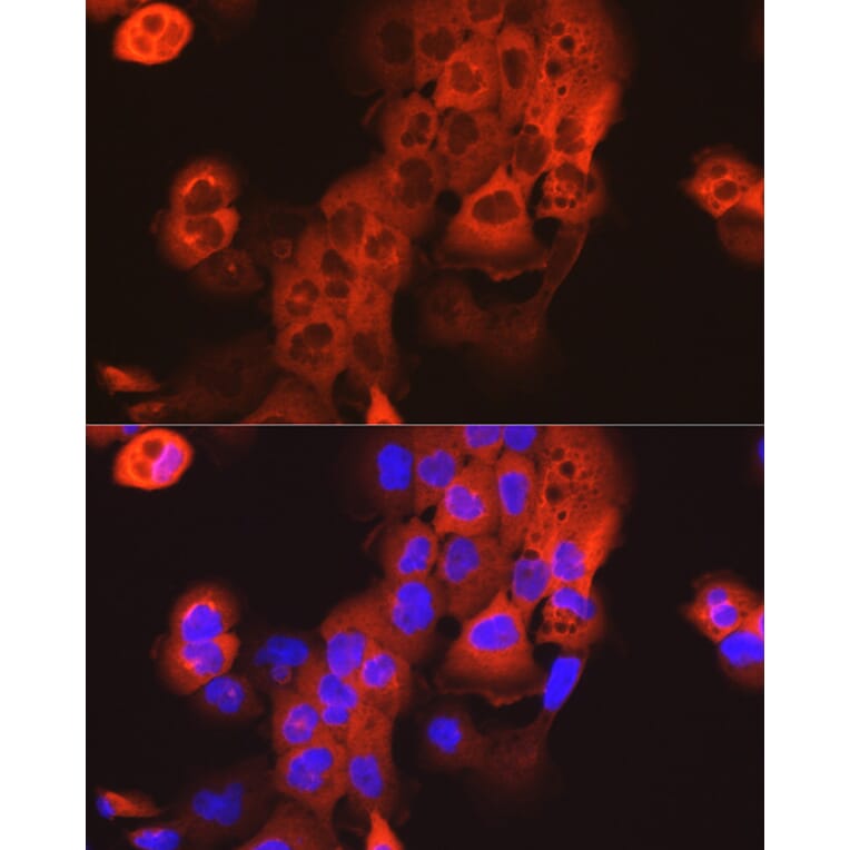 Immunofluorescence - Anti-Cytokeratin 15 Antibody (A14120) - Antibodies.com