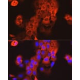 Immunofluorescence - Anti-Cytokeratin 15 Antibody (A14120) - Antibodies.com