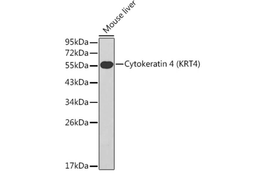 Western Blot - Anti-Cytokeratin 4 Antibody (A14121) - Antibodies.com