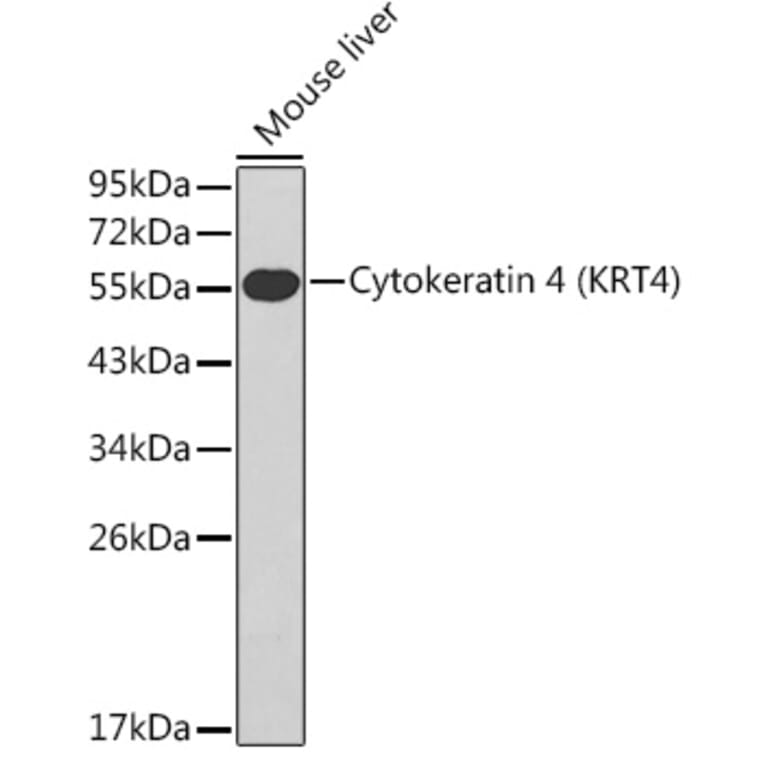 Western Blot - Anti-Cytokeratin 4 Antibody (A14121) - Antibodies.com