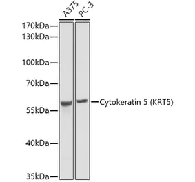 Western Blot - Anti-Cytokeratin 5 Antibody (A14122) - Antibodies.com