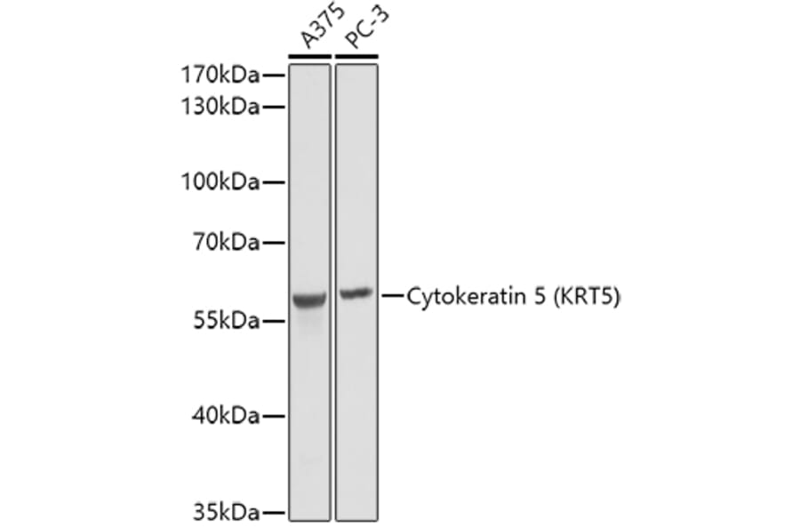 Western Blot - Anti-Cytokeratin 5 Antibody (A14122) - Antibodies.com