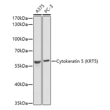 Western Blot - Anti-Cytokeratin 5 Antibody (A14122) - Antibodies.com