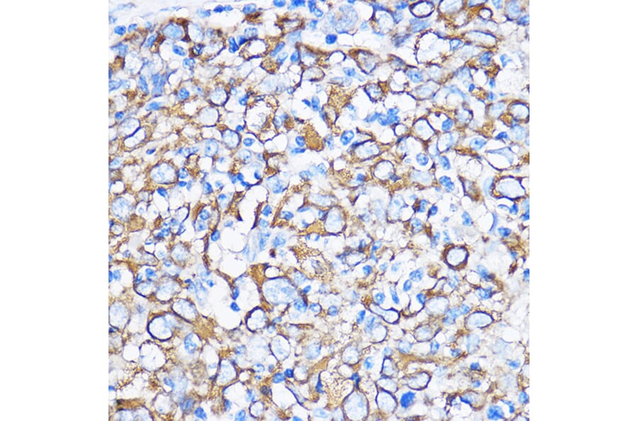 Immunohistochemistry - Anti-Cytokeratin 5 Antibody (A14122) - Antibodies.com