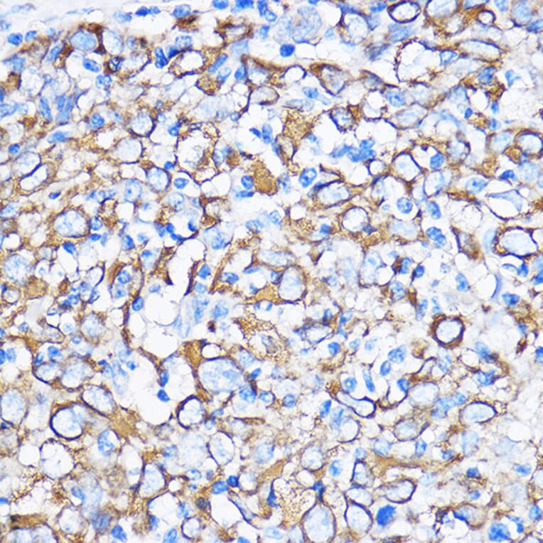 Immunohistochemistry - Anti-Cytokeratin 5 Antibody (A14122) - Antibodies.com