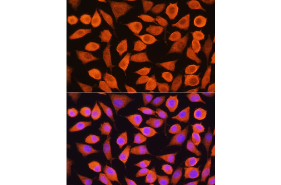 Immunofluorescence - Anti-Cytokeratin 5 Antibody (A14122) - Antibodies.com