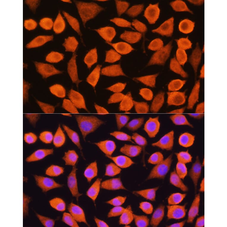 Immunofluorescence - Anti-Cytokeratin 5 Antibody (A14122) - Antibodies.com