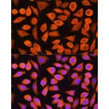 Immunofluorescence - Anti-Cytokeratin 5 Antibody (A14122) - Antibodies.com